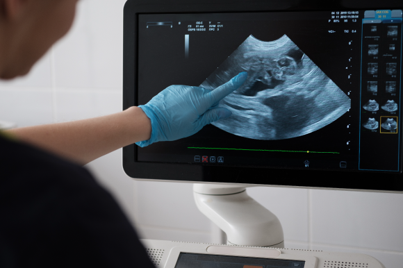 FAST Vision ActiveX Components(Windows向けライブラリ)